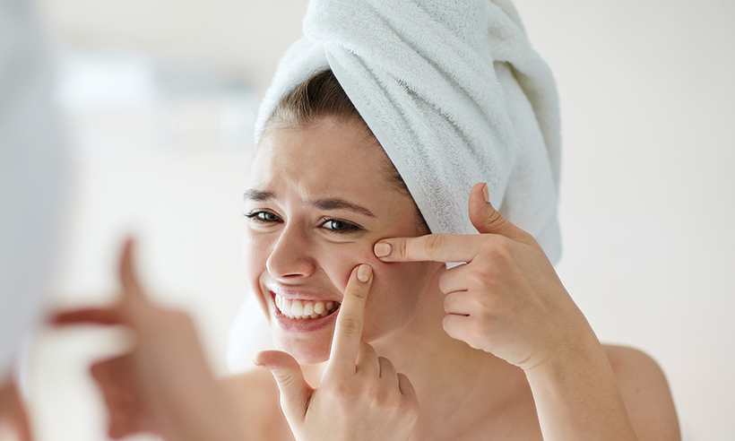 Acne Treatment Toronto