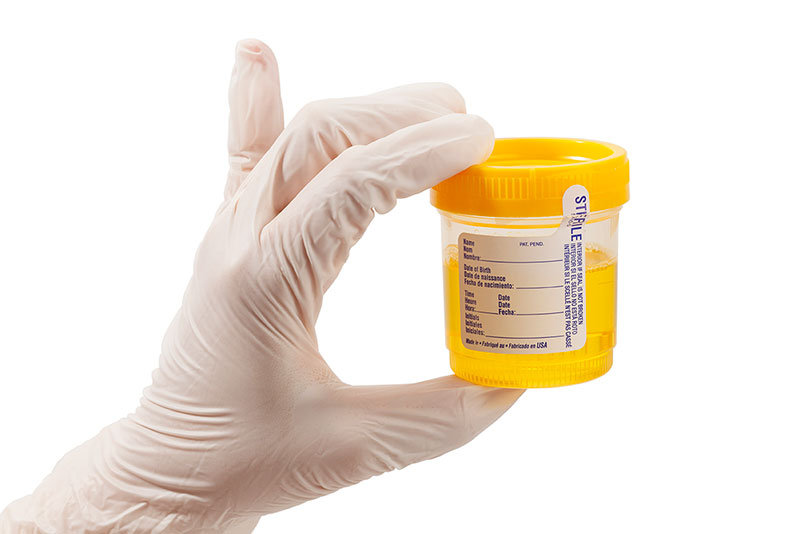 Urine-Drug-Test