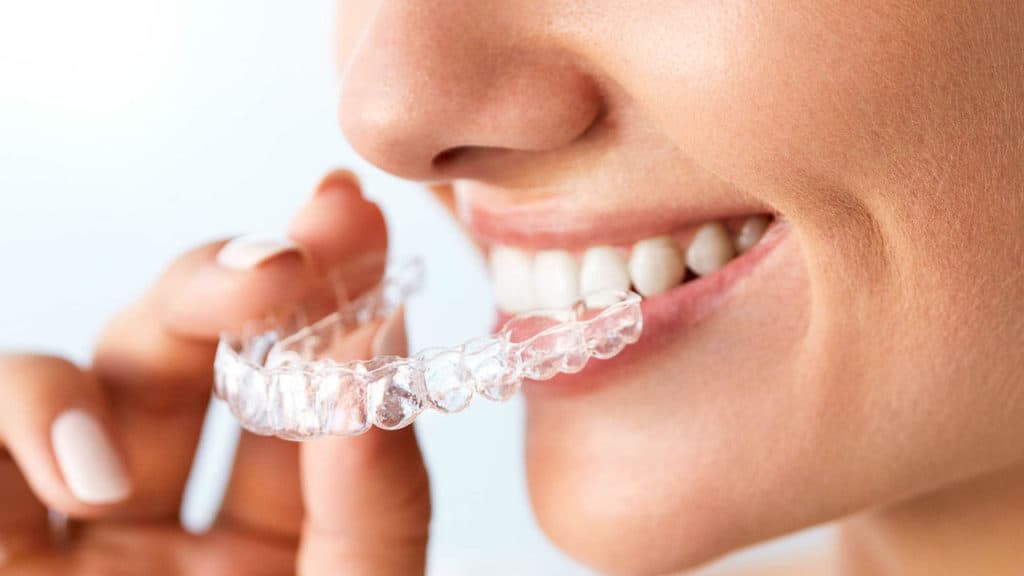 Invisalign Braces